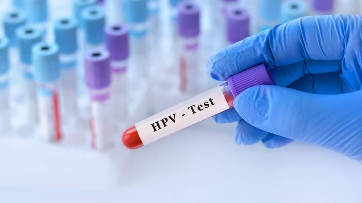 Al via il progetto per la prevenzione del papilloma virus per gli studenti universitari e Afam - papilloma virus