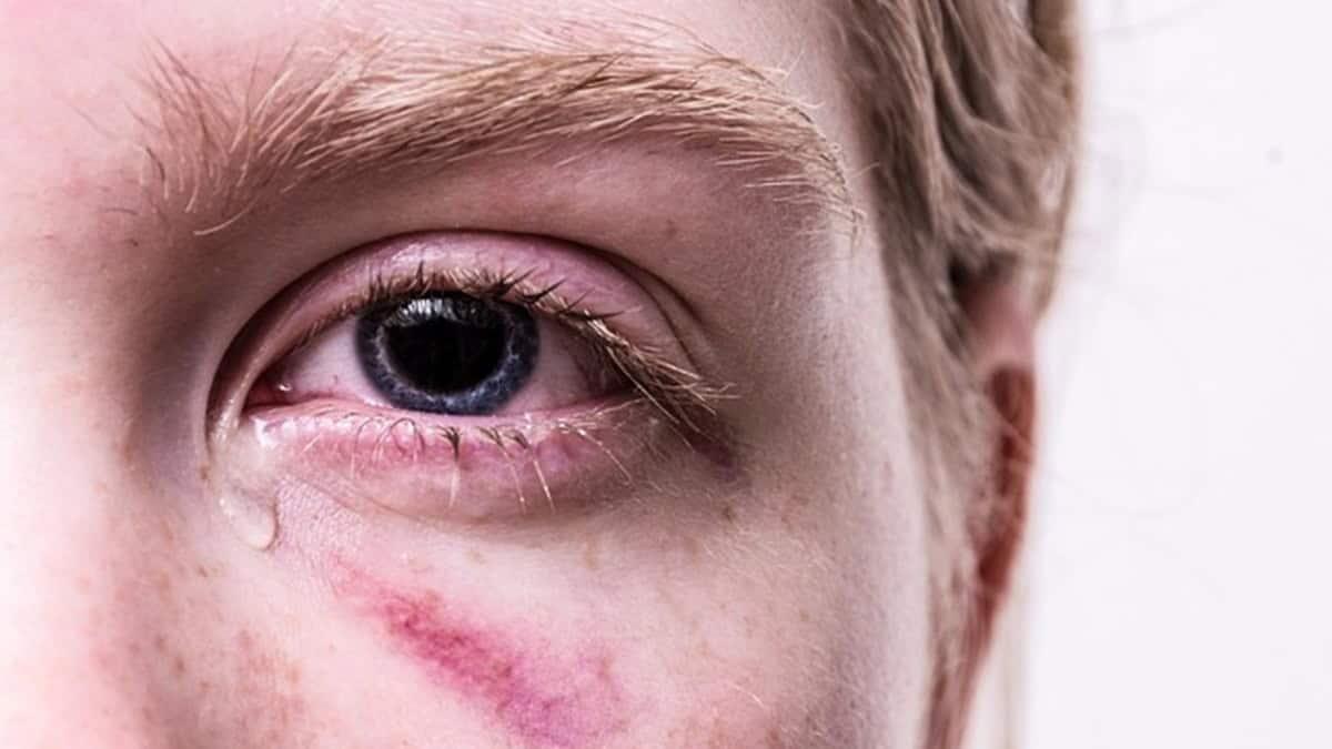 Ancona, bambino con lividi a scuola: madre condannata per percosse e sospesa dalla potestà - Bimbo con lividi
