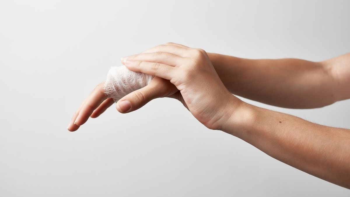 Infortuni sul lavoro in crescita nel 2025: il picco tra gli studenti - Infortunio alla mano